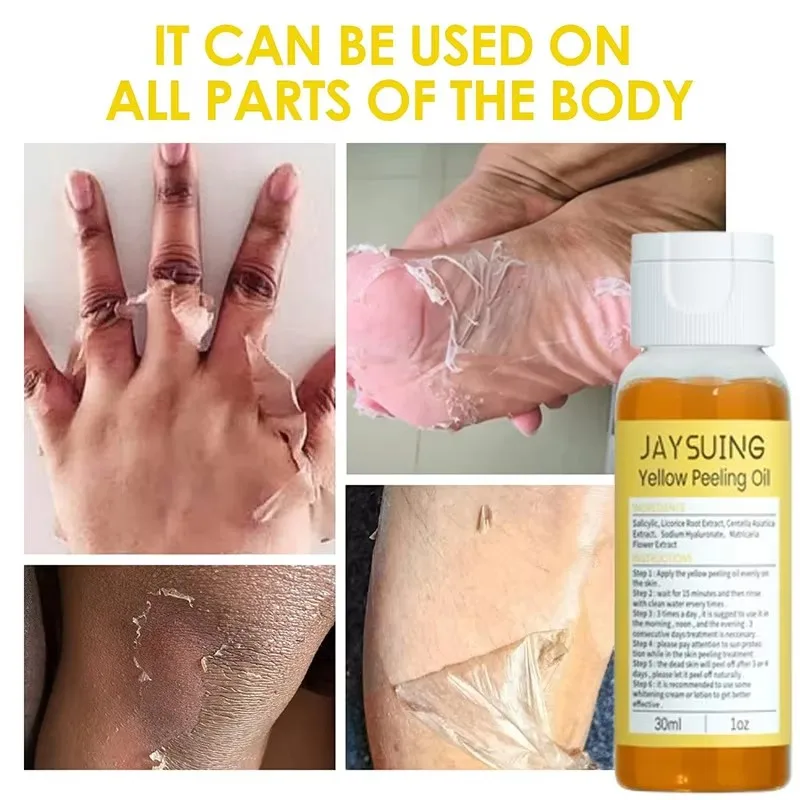 Olio peeling giallo Pulizia del corpo Esfoliazione per la pelle tenera e luminosa Articolazione delle dita Sbiancamento Cura idratante Prodotti di