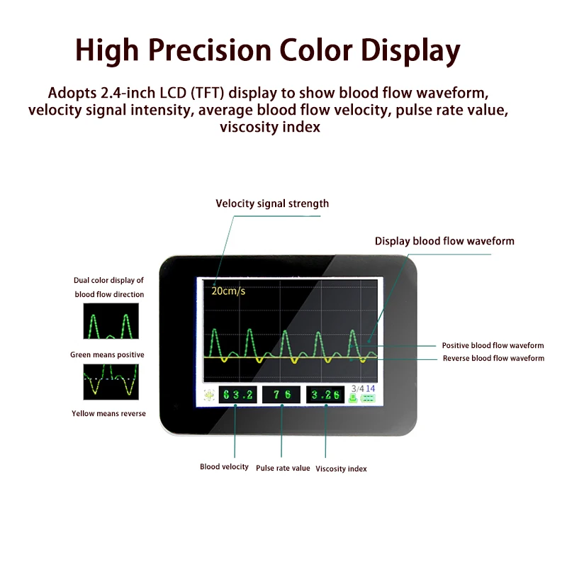 Blood Flow Velocity In Arteries&Veins Real-Time Waveform LCD Display &Integrated Printer Hand Held Bidirectional Pocket Doppler