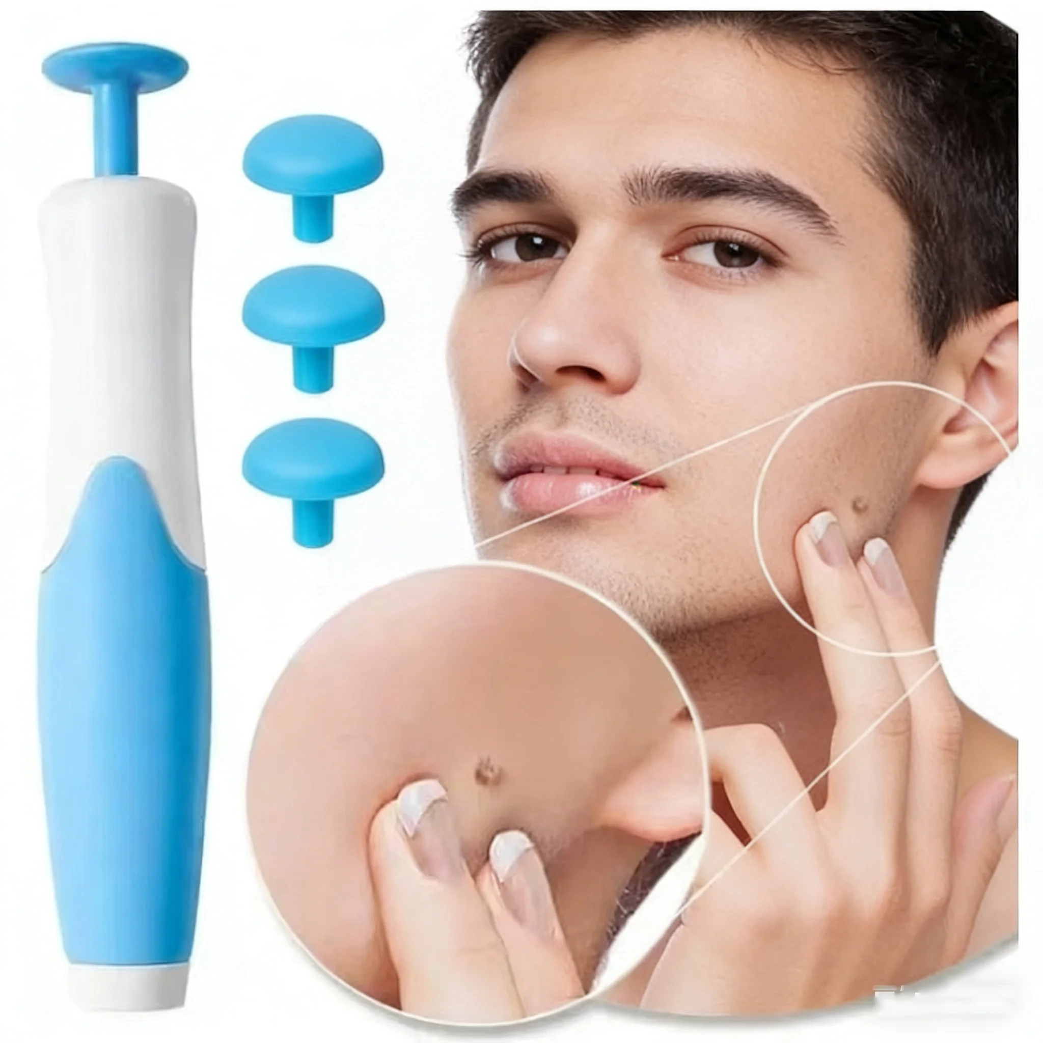 2 in 1 얼굴 점 제거 도구 세트, 고무 링, 얼굴 미용 액세서리 사마귀 제거 키트 용품 바디 사마귀 점 치료