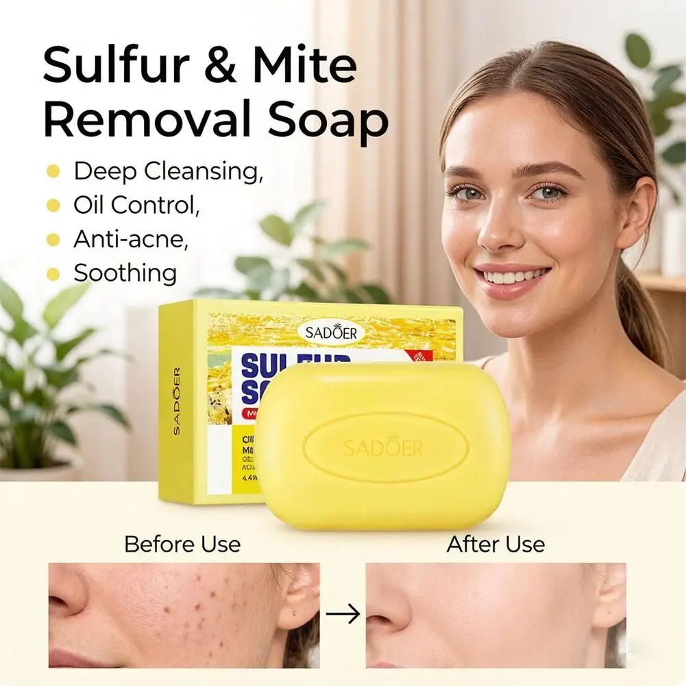 Sulfur Cleansing Bar Face Body Soap Mite Removal Oil Control Acne Deep Pore Clean Moisturizing Skin Care Handmade Bath Bar