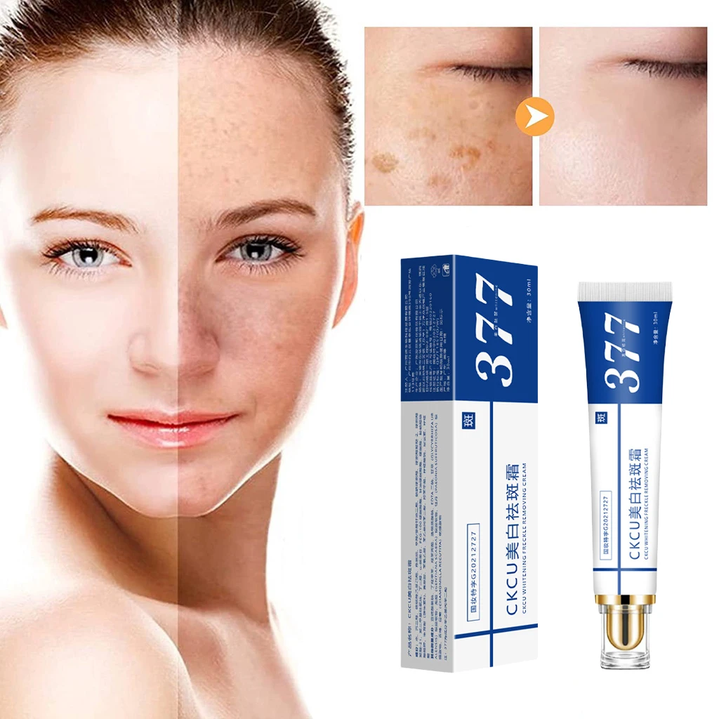 Effective Whitening Freckle Cream Remove Melasma Acne Spot Pigment Melanin Dark Spots Pigmentation Moisturizing Gel Skin Care