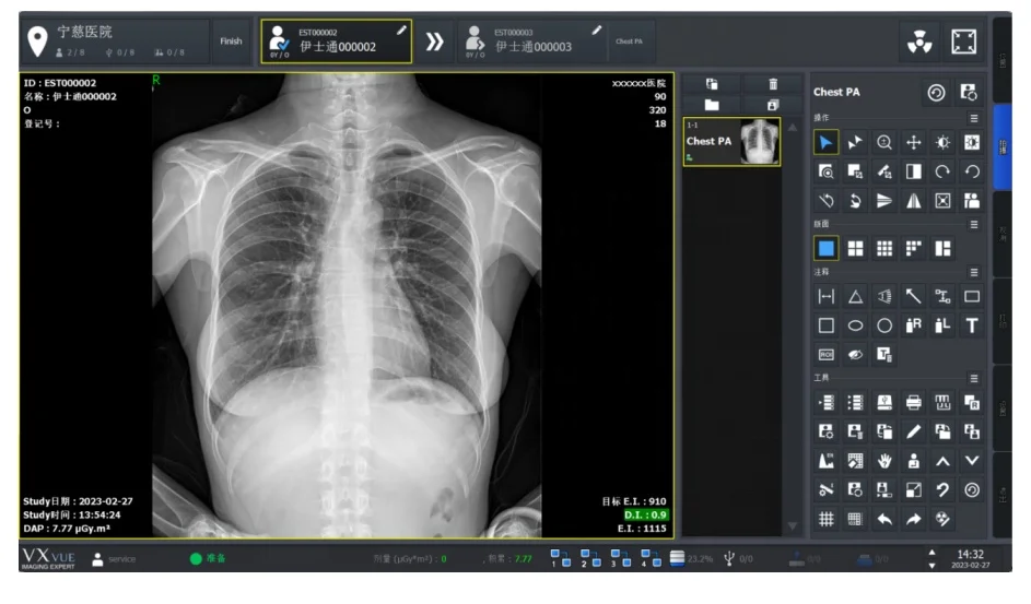 Latest Design Mobile Radiography High Frequency Medical X Ray Imaging X-Ray Medical Jiangsu Medical-X-Ray-Machine Price