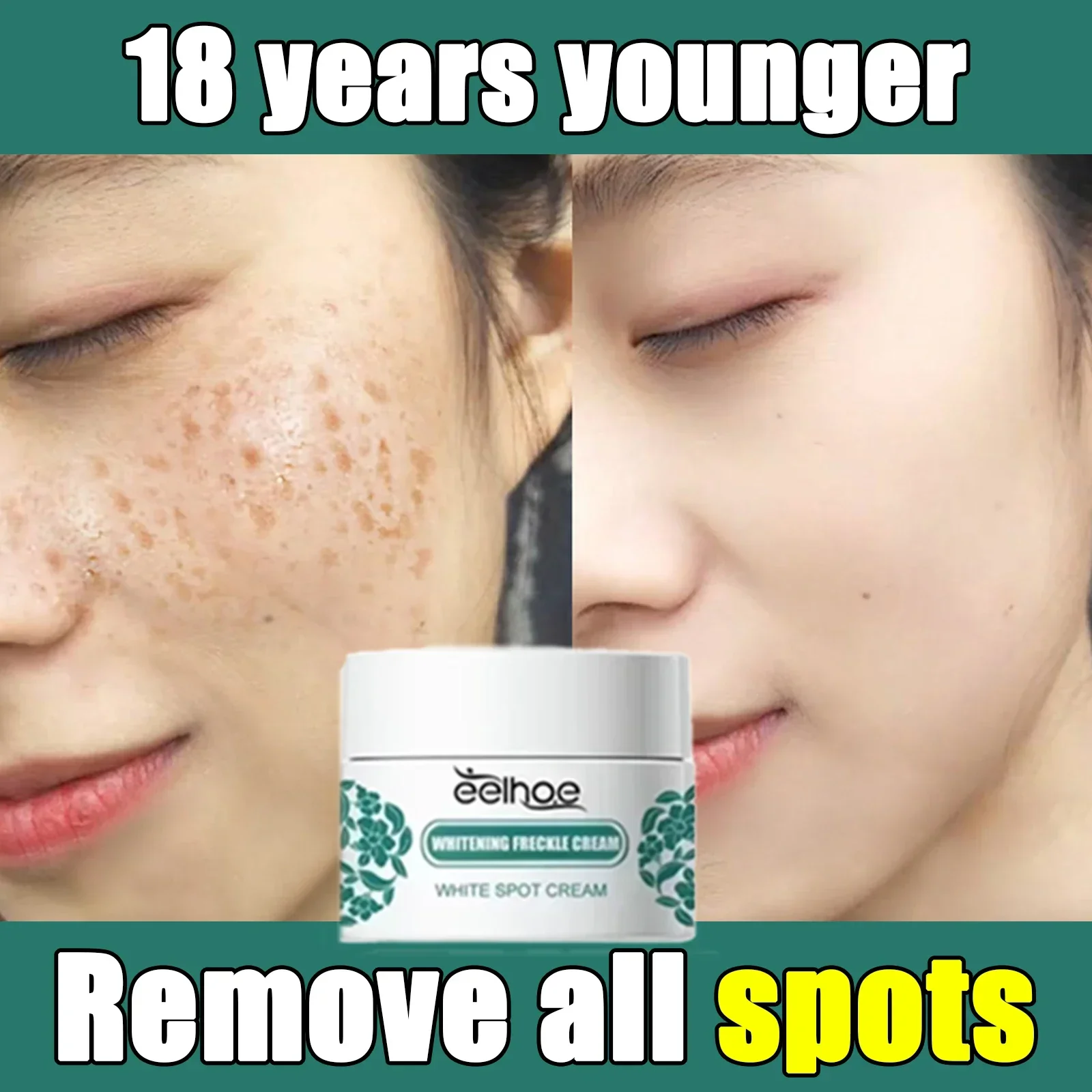 

Removal Freckles Dark Spots Brighten Facial Skin Firming Whitening Frckle Products Reduce Melanin Lighten Dark Skin