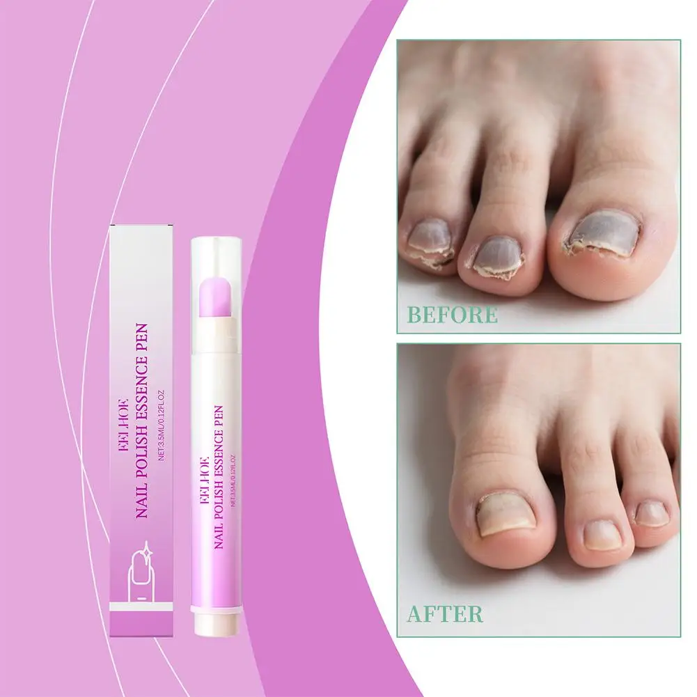 Stylo à Essence de vernis à ongles, adoucit l'élimination des peaux mortes, hydratant, nourrissant, armure de bord, renforce l'armure de levage, soins portables des ongles