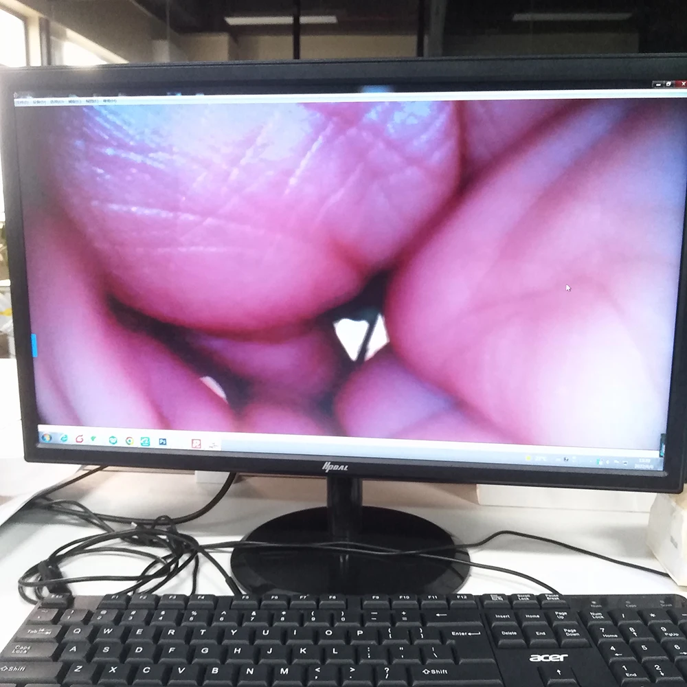 أصغر مستشعر الصورة الطبية بالكامل OVM 6946 HD 400 P