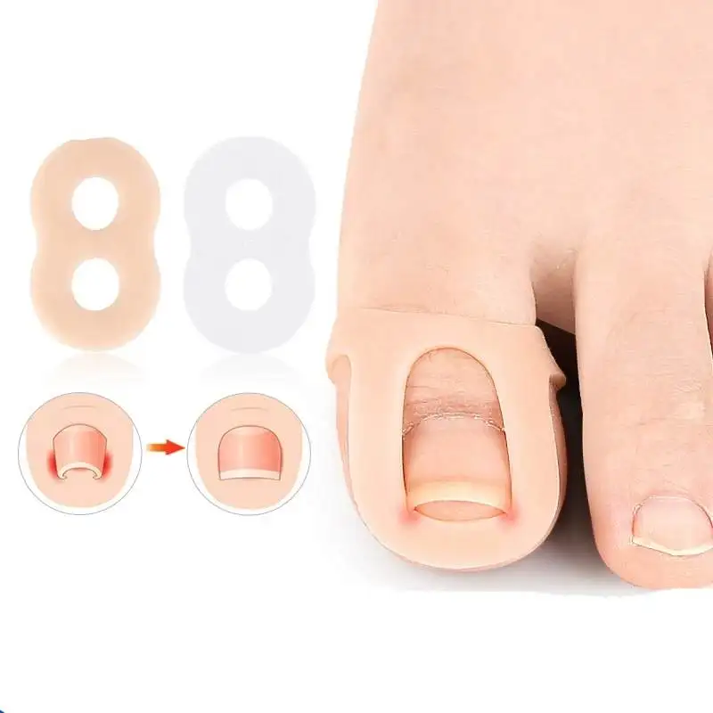 1/5/10Pairs Silicone Ingrown Toenail Correction Invisible Ingrown Toe Nail Elastic Straightening Clip Brace Protector Foot Tool