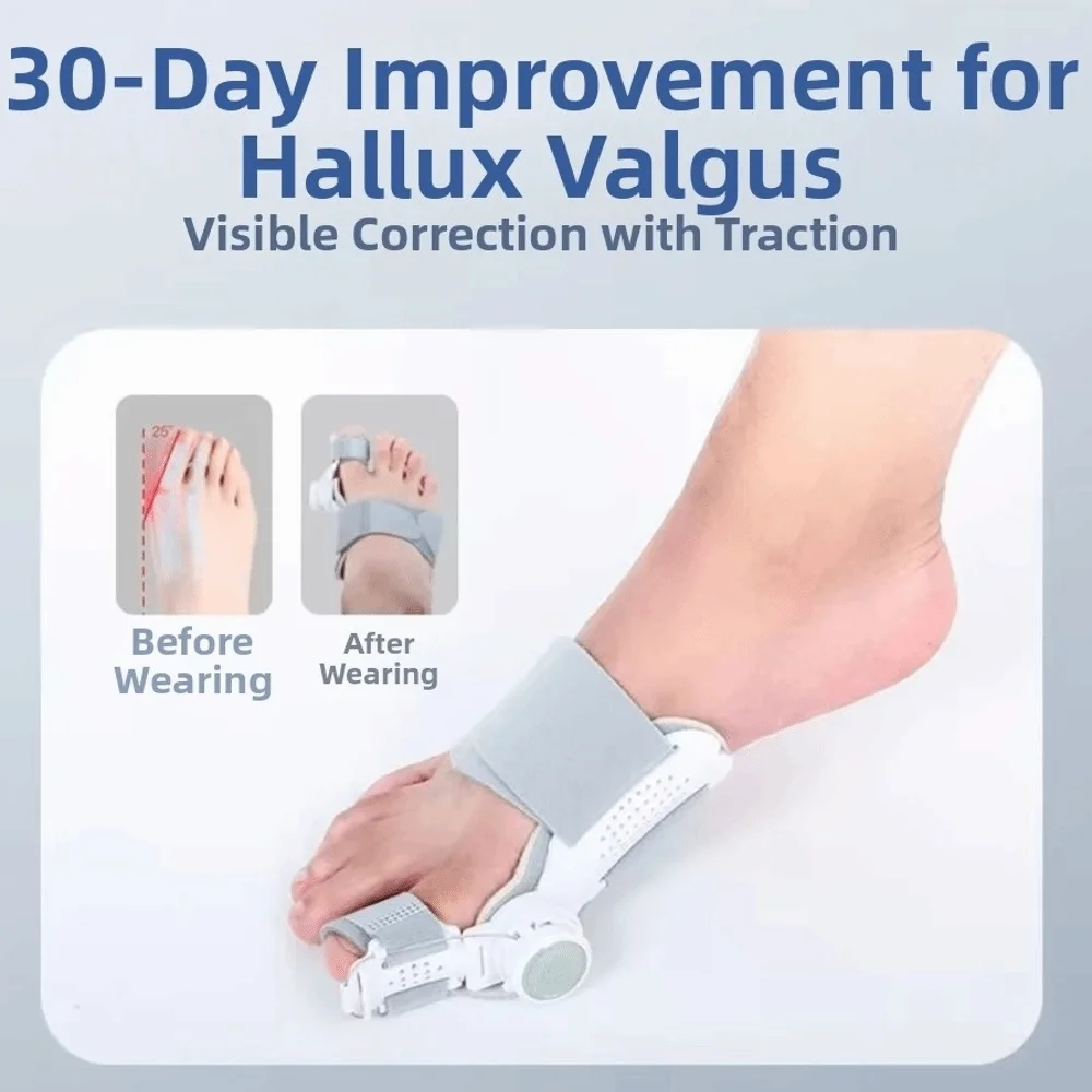 Rotatable Bunion Corrector Adjustable Strap Orthopedic Toe Separator Anti-slip Heel Hallux Valgus Corrector Left Right Feet