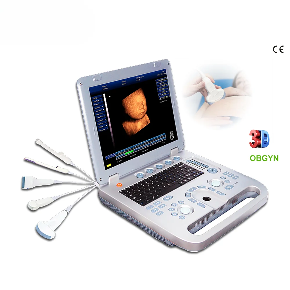 

OBGYNS 3D baby scanner ultrasound portable pregnancy scanning ultrasound