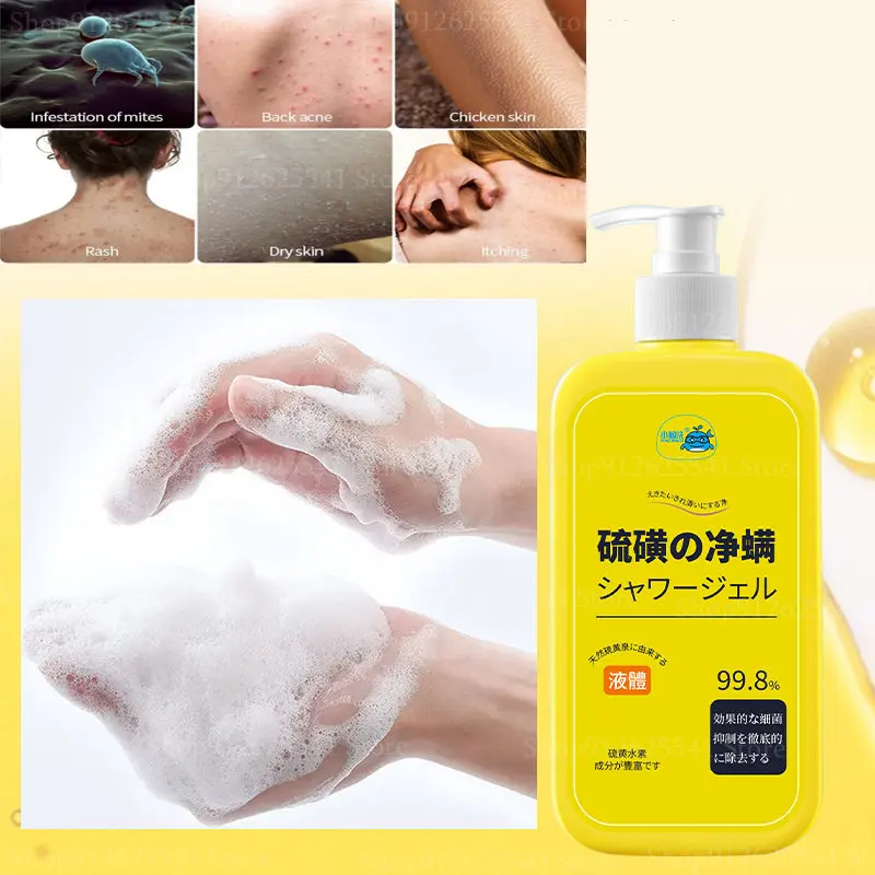 300ml Sulfur Anti-mite Liquid Soap Lasting Itching Oil Control Acne Moisturizing Net Mite Antibacterial Cleaning Wash Shower Gel