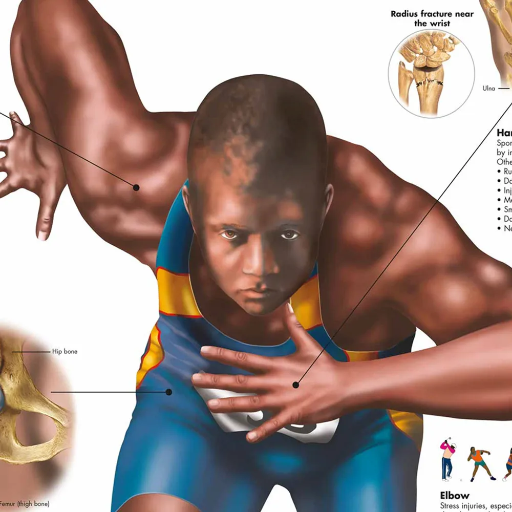 Sports Injuries Posters Prints Wall Chart Human Anatomy Picture Wall Art Canvas Scroll Painting Hospitals Clinics Home Decor