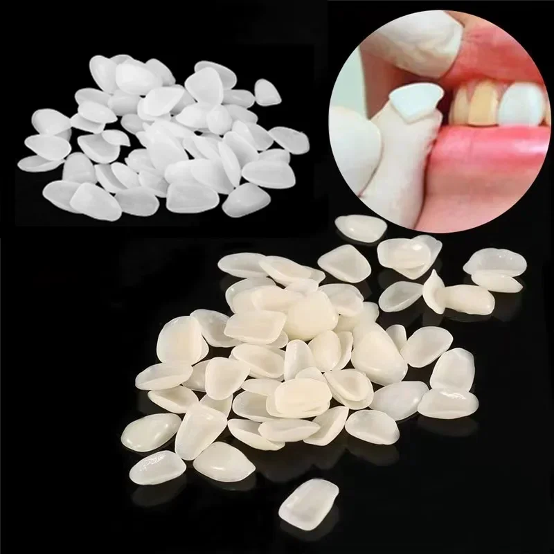 500 PCS Teeth Veneers Resin Temporary Crown Ultra Thin Repair Whitening  Sets Dentist False Tooth Oral Care Cleaning Materials