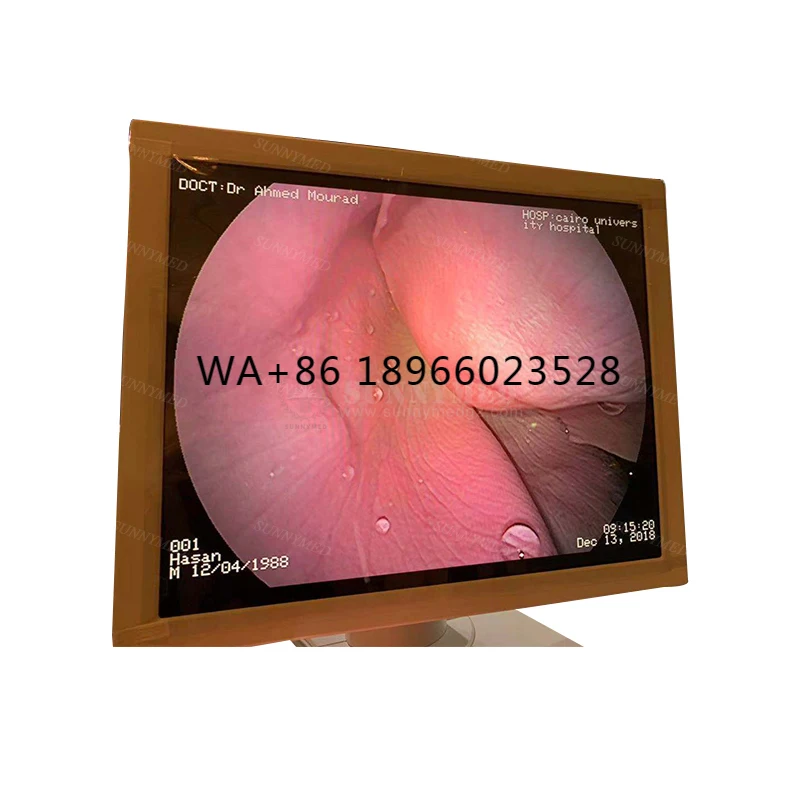 SY-P006 Guangzhou video gastroscope cost operation endoscope