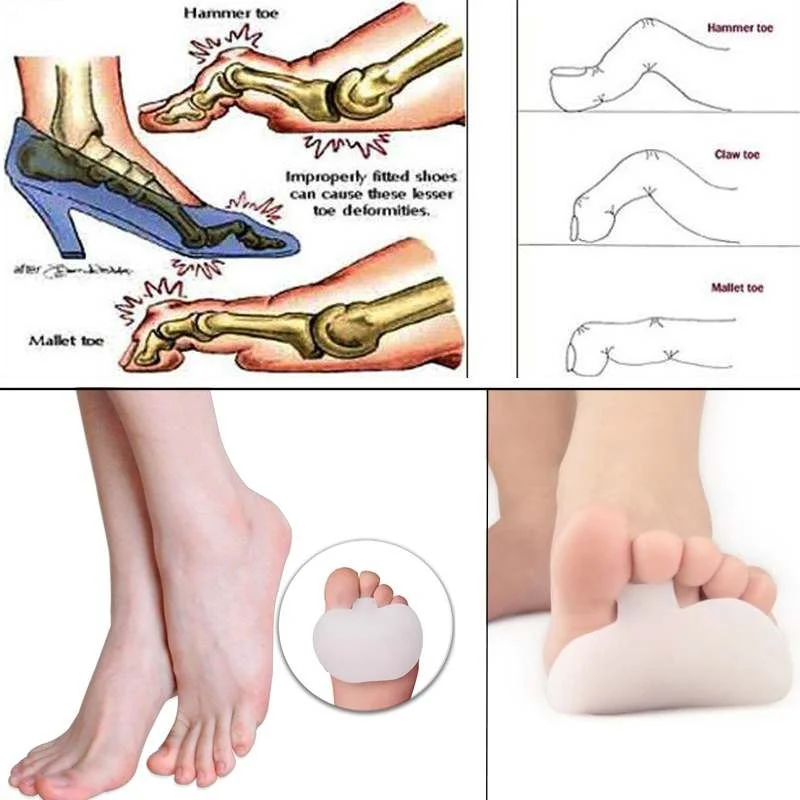 1 Pair Comfortable Silicone Metatarsal  Gel  2 Pcs Foot Toe Pads For High Heels Lady Girl