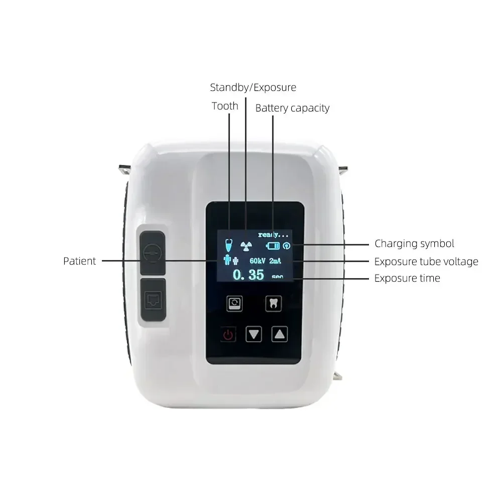 Oral Portable Dental X-Ray Unit: High Frequency Digital Imaging System, Cost-Effective and Reliable Intraoral Diagnostic Tool