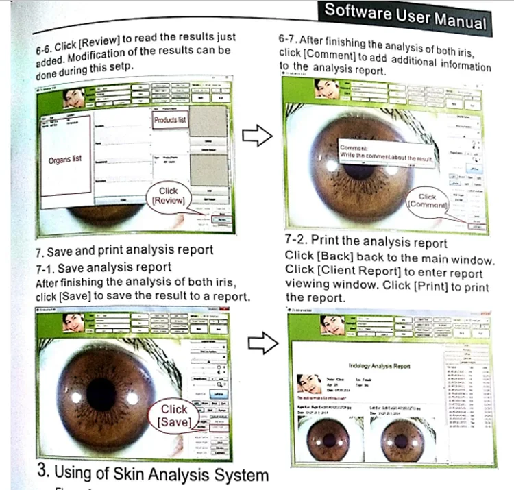 spagnolo coreano russo Polonia 12MP iriscopio iriscopio occhio iridologia software professionale