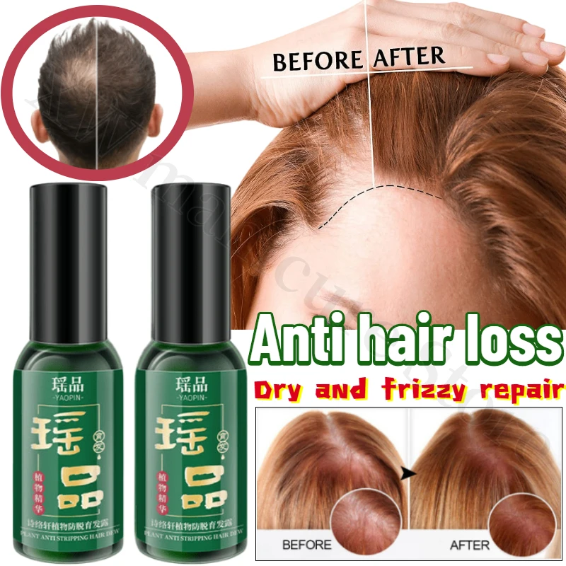 

Polygonum Multiflorum Anti-hair Loss and Hair-fixing Essence Improves Thinning Hair Nourishes and Repairs Dry and Frizzy Hair