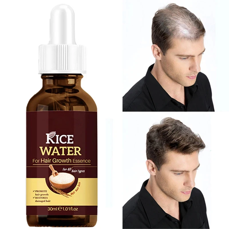 

Hair Growth Essence Anti-Fall Promote Hair Growth Nursing Oil Control Deep Nourishment Moisturize Hair Follicles Hair Care 30ml