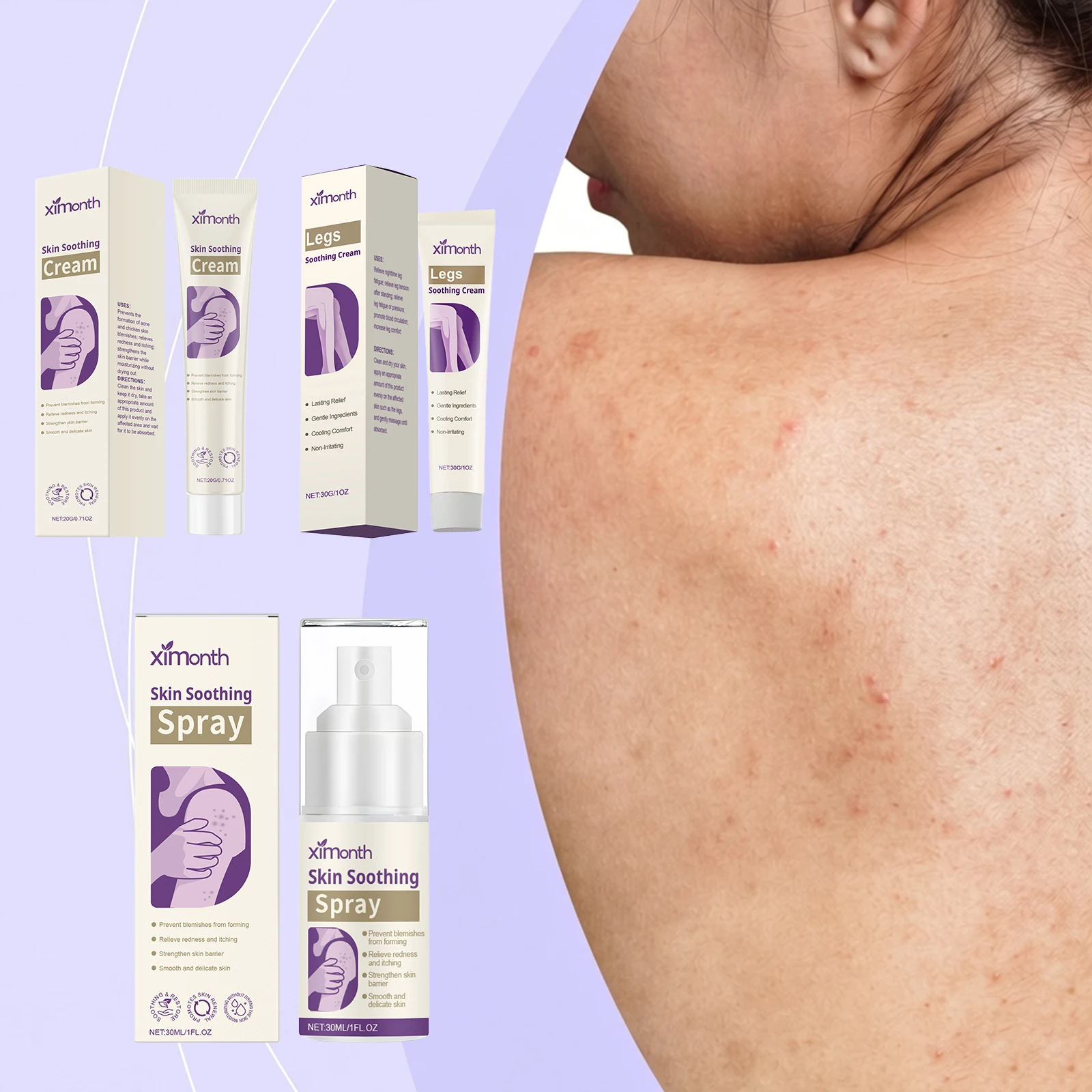 Soothing Cream To Remove Acne Relieve Itching And Remove Redness Smooth Tender Skin Take Care Of Your Skin Dry Skin Repair Balm
