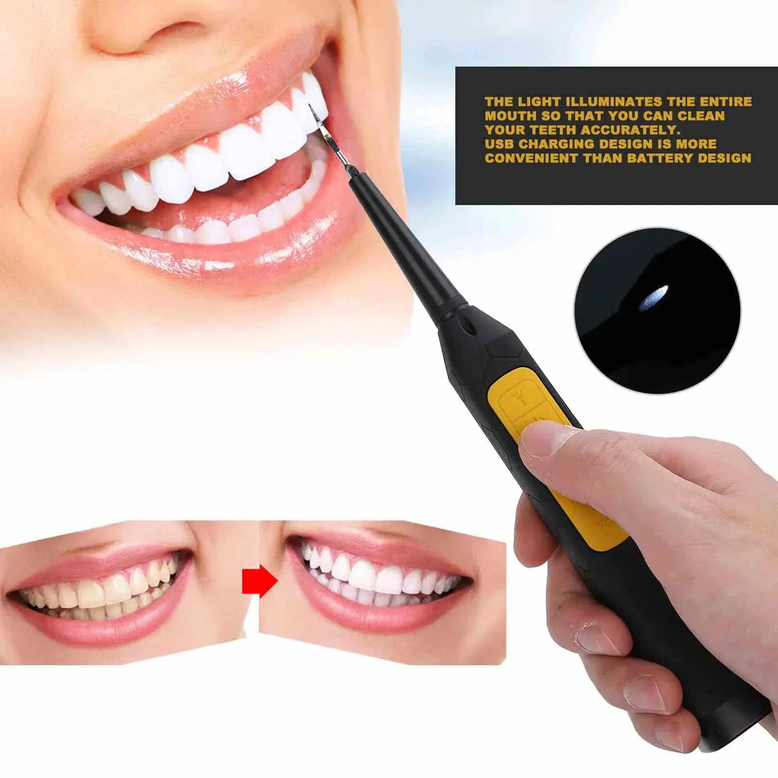 HighQuality Stainless Steel Head Tooth Cleaner Electric Calculus Remover Portable Teeth Tartar Remover Oral Care Tool USB Charg