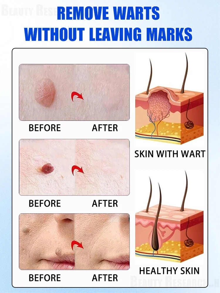 Fʟᴀᴡʟᴇss sᴋɪɴ