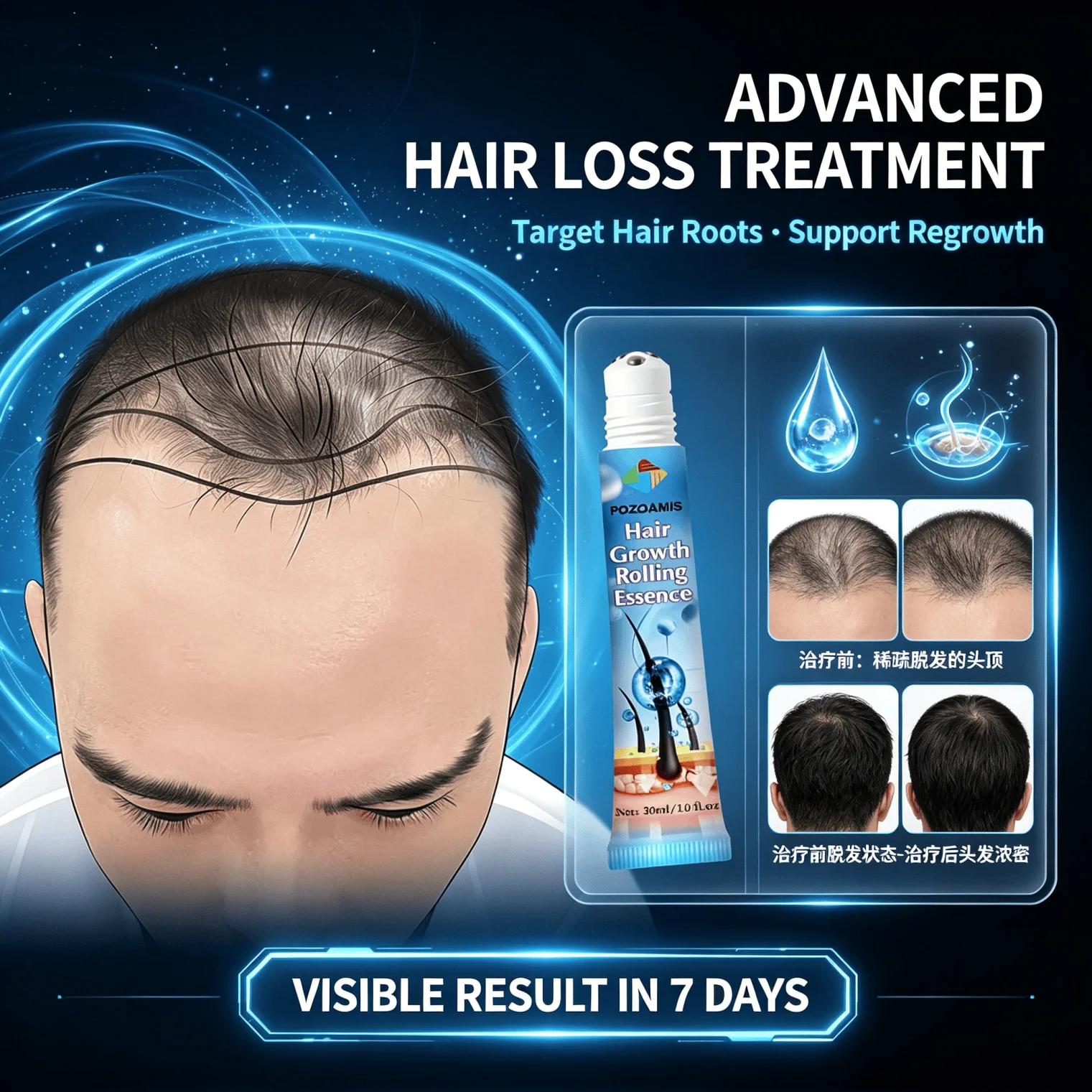 1 morning 1 evening Roller massage head - hair growth liquid,peptide molecules,Original essence,Hair regrowth tips