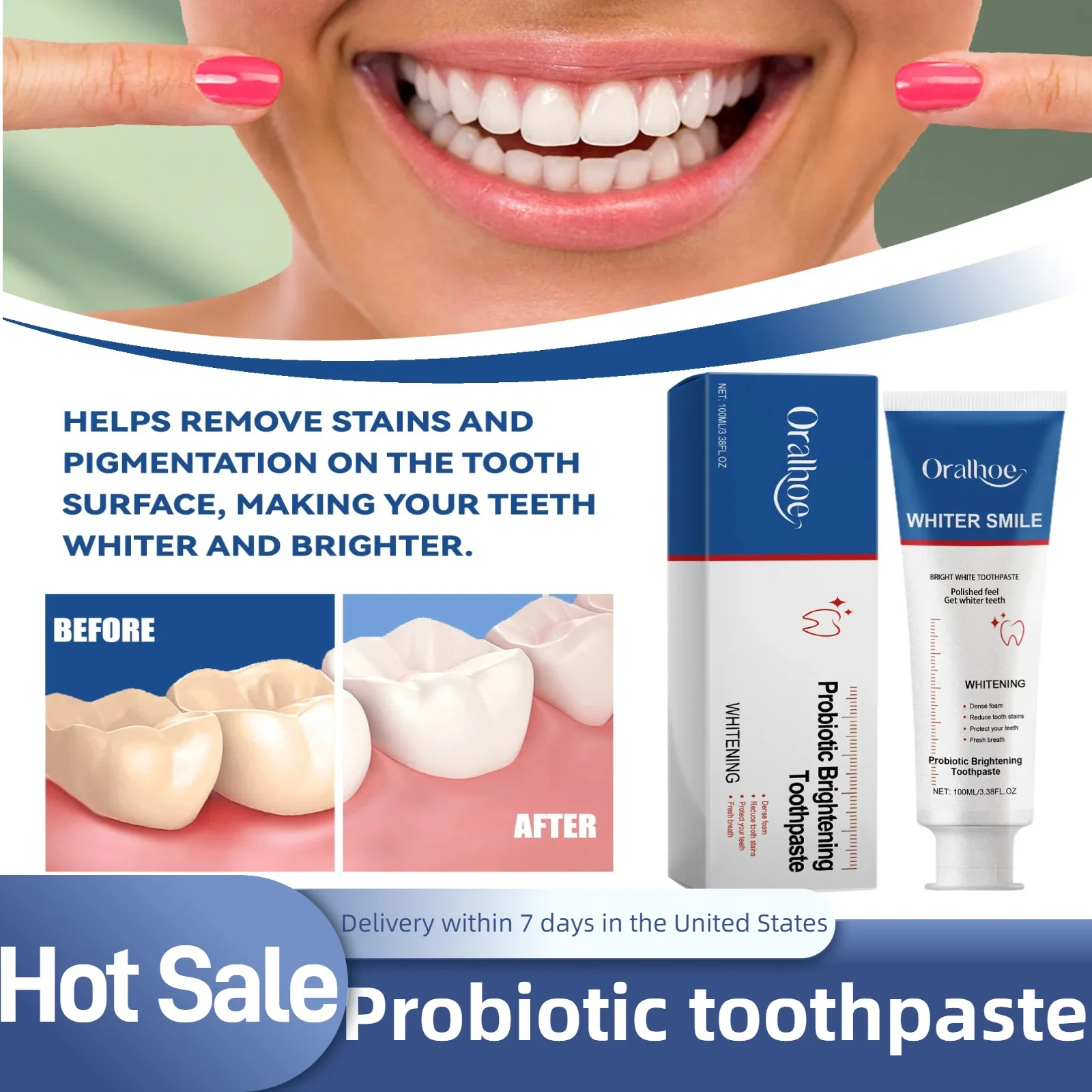 Probiotic Toothpaste Brightens Teeth, Removes Yellow Teeth and Stains, Tooth Cleaner, Oral Hygiene, Cleans and Freshens Breath