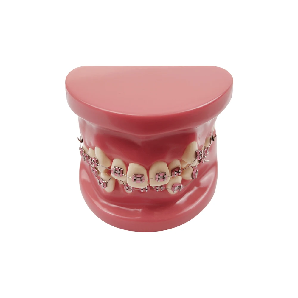 Dental Orthodontic Teaching Model Teeth Malocclusion Practice Model for Dental Technician Training Study Communication Tool