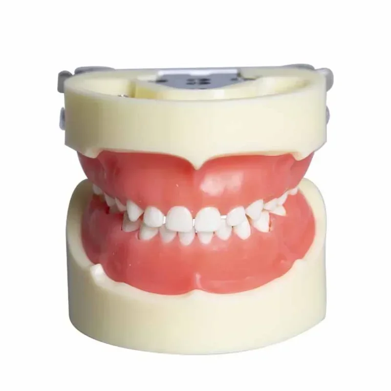 

Children's Deciduous Tooth Model Removable Caries Model Children's Dental Caries Grain Oral Teaching Demonstration Dental Model