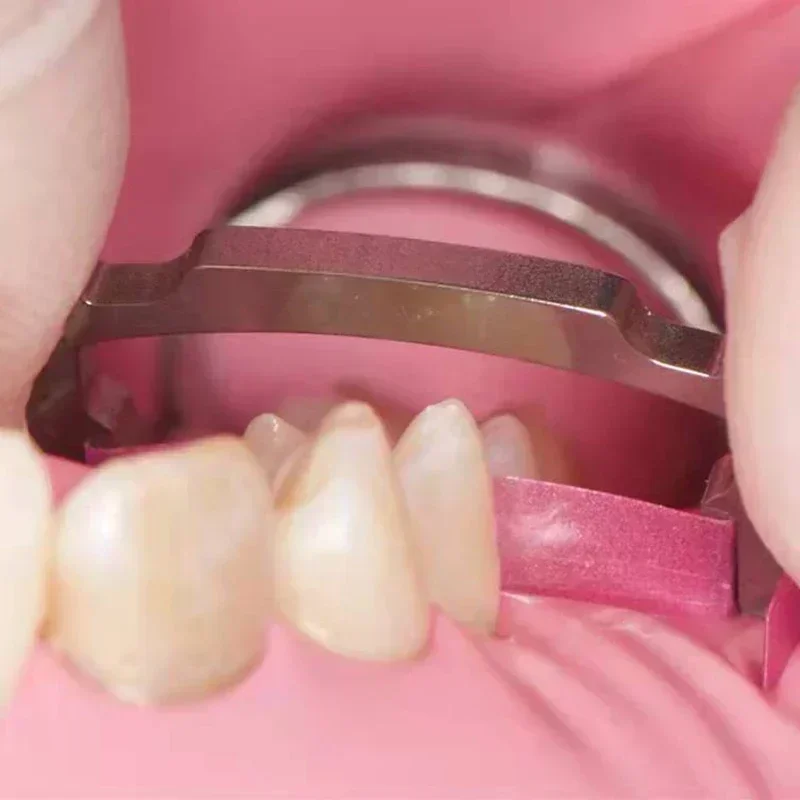 

2Pcs/set Dental Polishing Strip Holder Fit Low/high Crown Metal and Resin Polishing Strips Autoclavable Dental Tools Dentistry