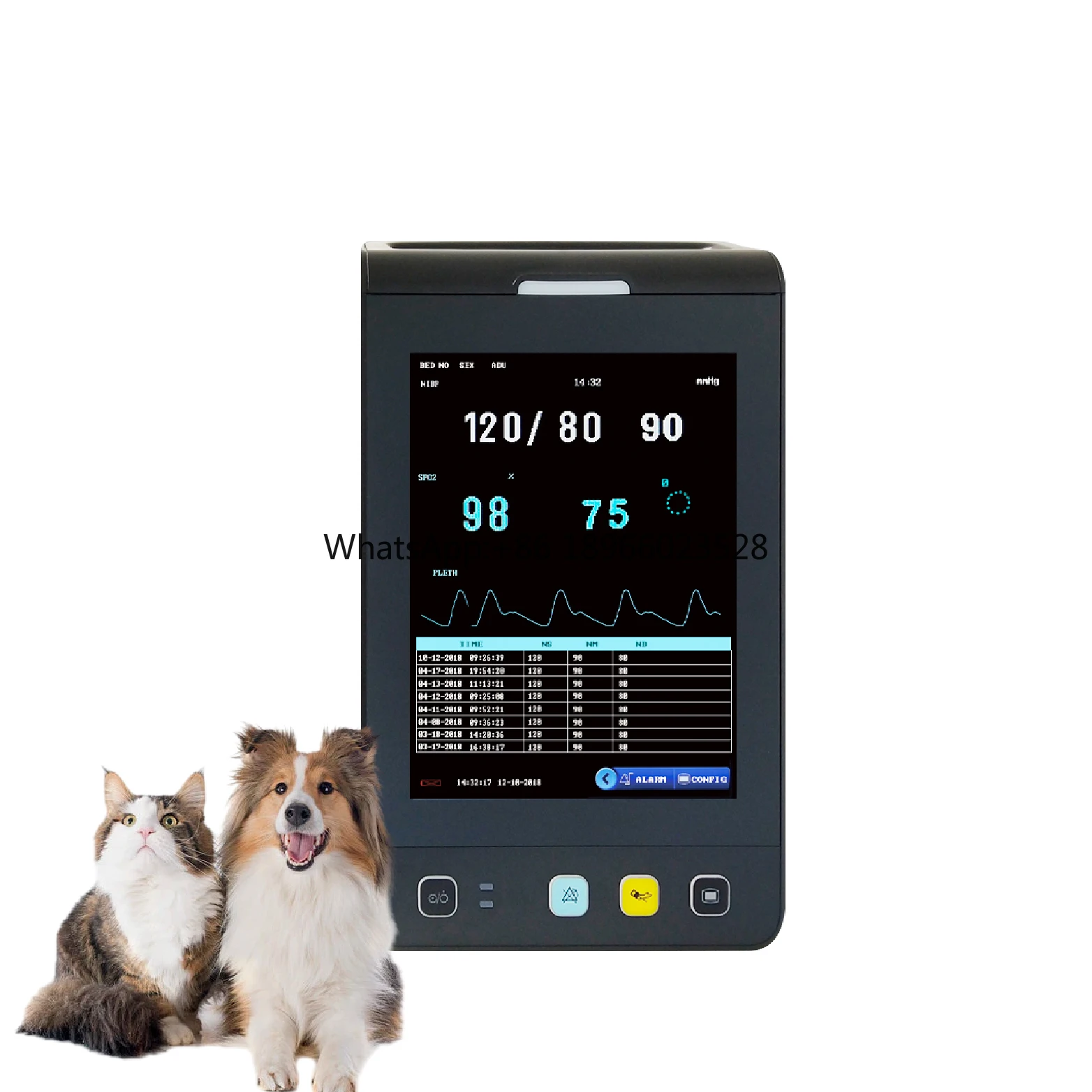 

Handheld Veterinary Hospital Equipment Cardiac Vital Sign Parameter Portable Medical Vital Sign Monitor