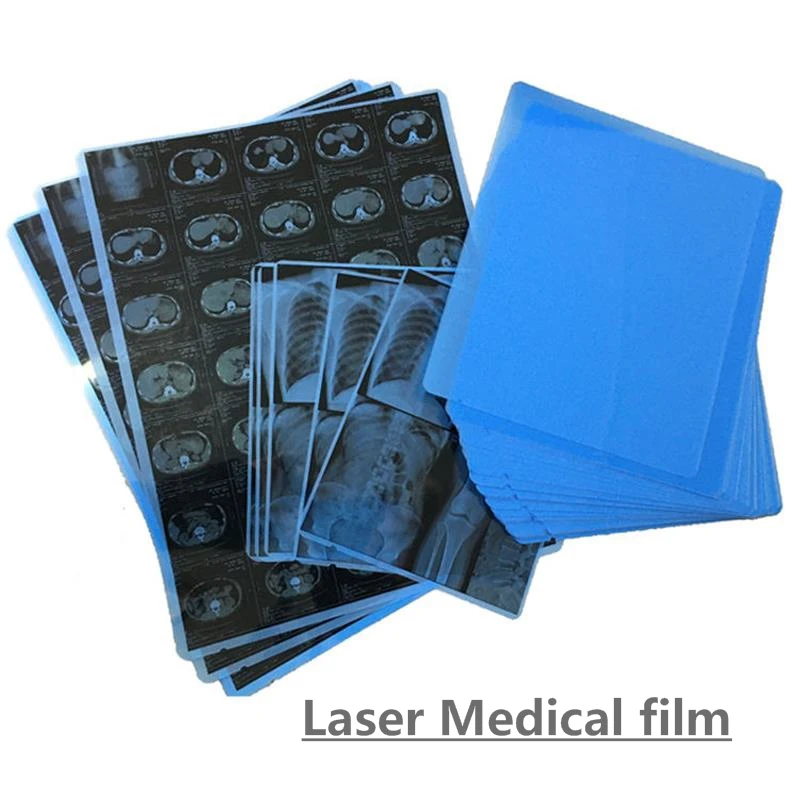 100 Pieces A4 14*17 Medical Inkjet Dry Laser X-ray Imaging Blue Film for medical devices