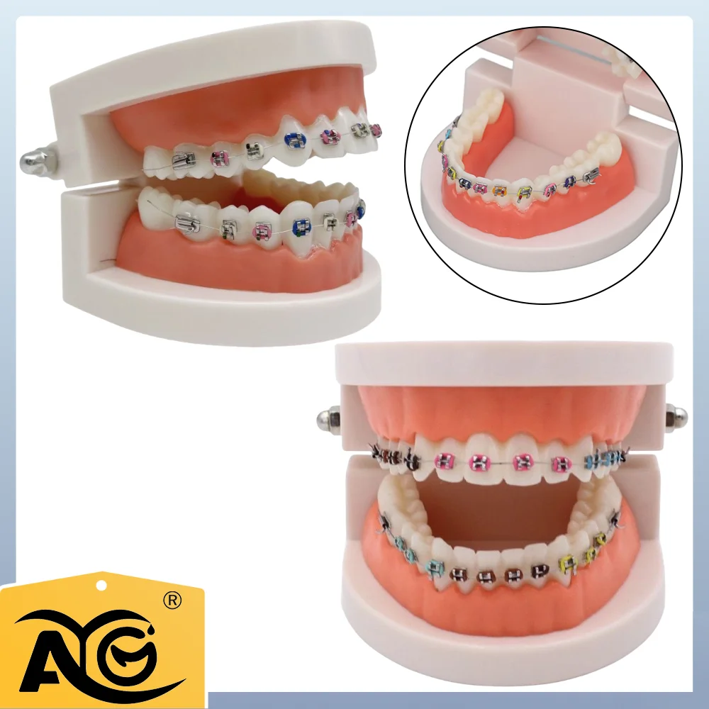

AG Dental Orthodontic Teeth Model with Colorful Braces, Professional Denture Mouth Model Demonstration Study Tool for Dentistry