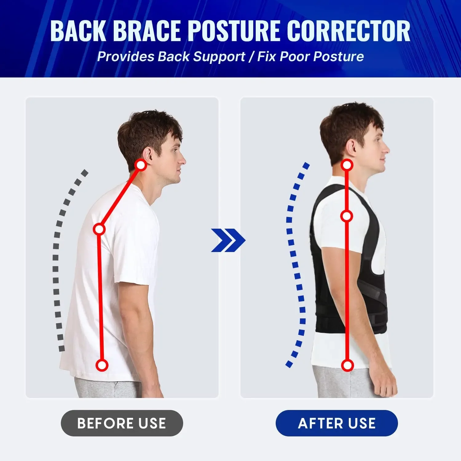 Back Brace and Posture Corrector for Men and Women, Back Straightener Posture Corrector Scoliosis & Hunchback Correction Support