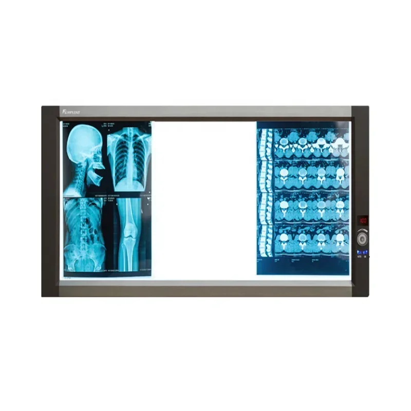 2025YSX-GPD03 X Ray Machine Triple LED XRay view box Medical X ray radiology system film Viewer hospital x-ray viewing box price