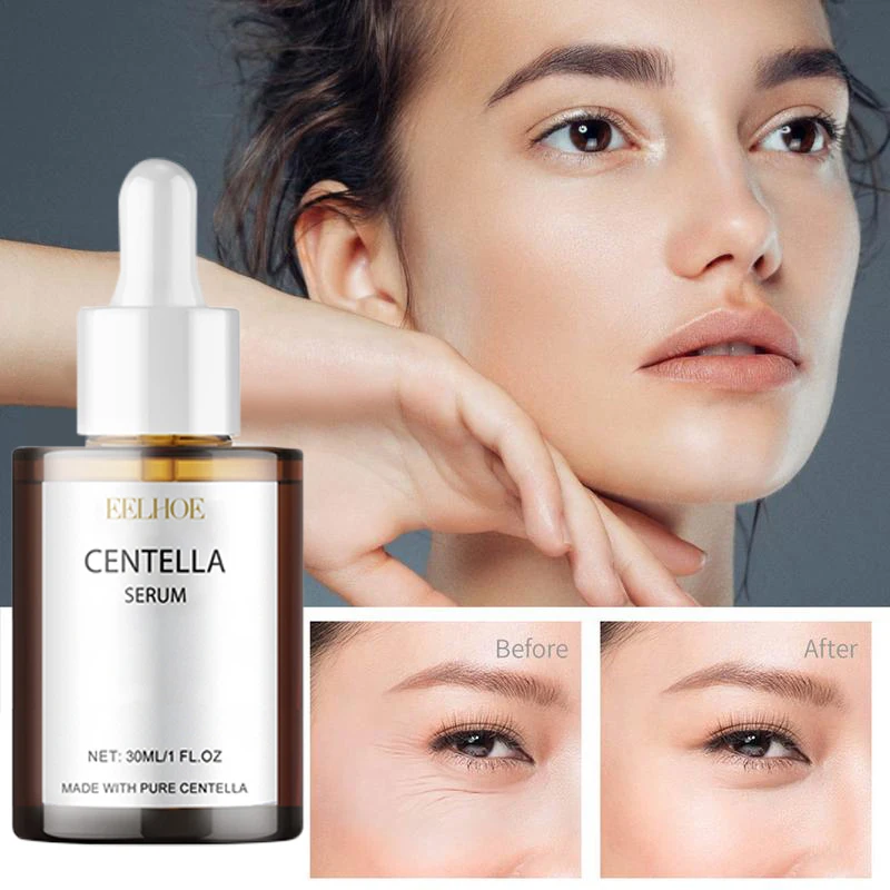 Korea Centella Asiatica Facial Serum Moisturize Nourish Improvement Dry Skin Smooth Rejuvenation Brightening Beauty Care Essence