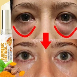 Turmeric Remove Dark Circles Eye Cream Stick Anti-Wrinkle Fade Fine Lines Anti Eye Bags Puffiness Lift Firming Brighten Eye Care