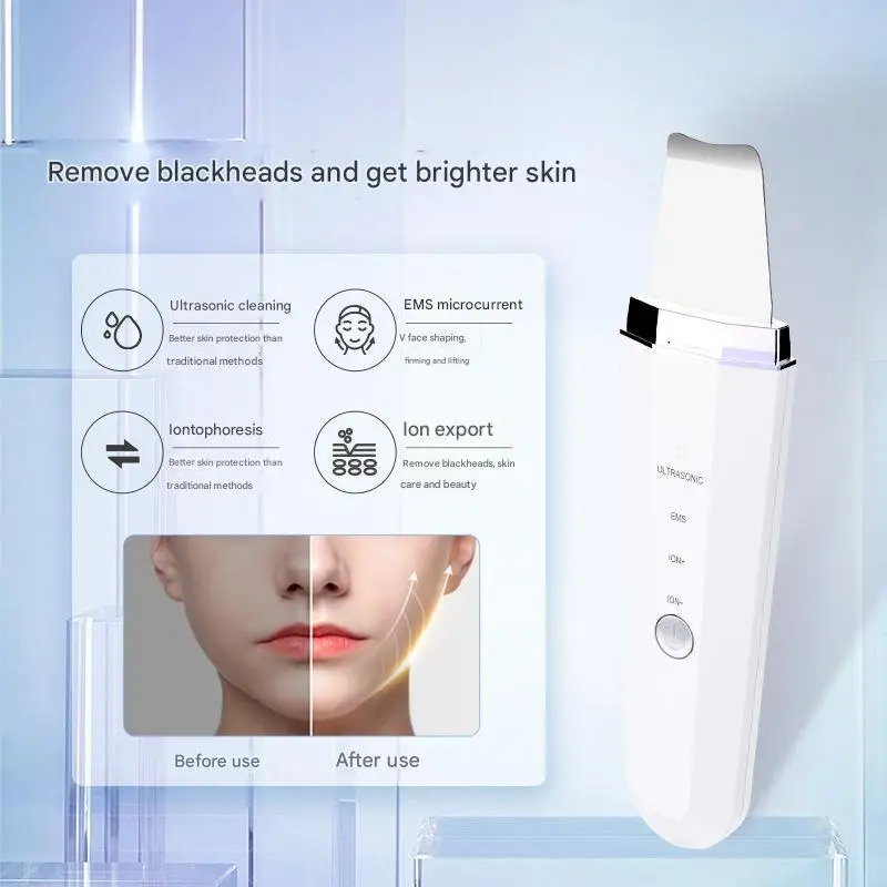 Dispositivo facial de microcorrente ems, limpador ultrassônico, esfoliação e limpeza de poros, limpeza profunda iônica, recarregável por usb, portátil para