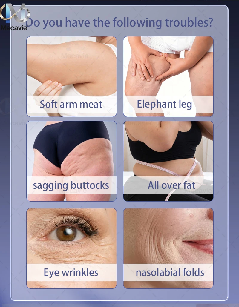 2026 جديد محمول 6500 واط MECAVIE إزالة الدهون الكنتوري العضلات التحفيز الكهربائي EMS الجسم 200 هرتز التخسيس مجموعات مسلم آلة #1