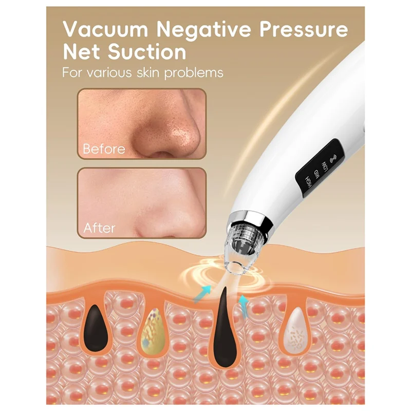 A39M Blackhead Remover Tools Blackhead Remover Vacuum Extraction Tools Forestheticians