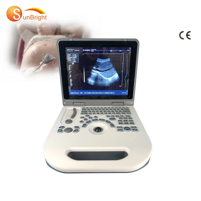 

Cost-effective Ultrasound SUN-806G Double Probes Ultrasound Laptop Ultrasound Linear Probe