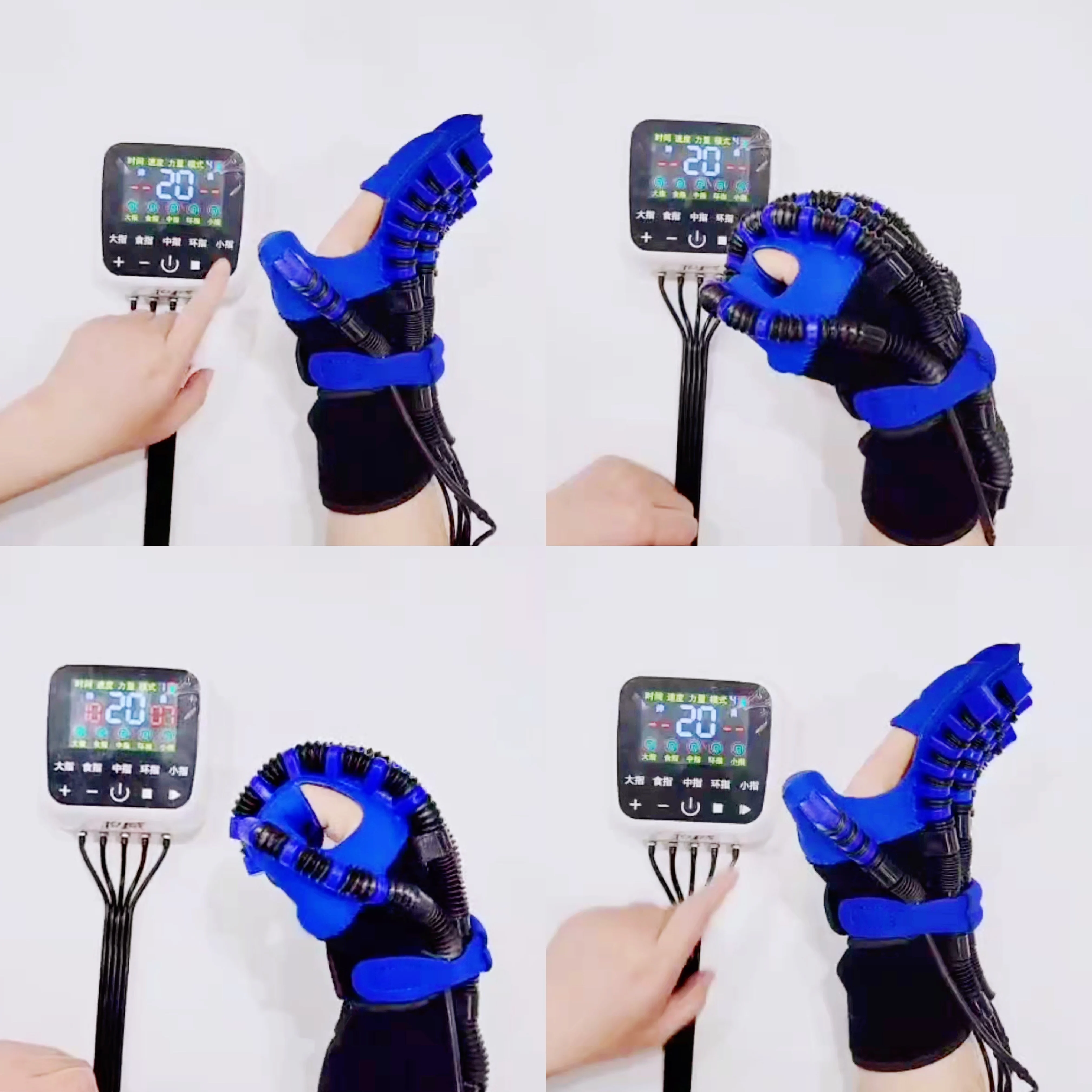 Upgrade Wrist&finger Rehabilitation High-tech Single Finger Rehabilitation, Powerful Stroke Hemiplegia Rehabilitation Glove