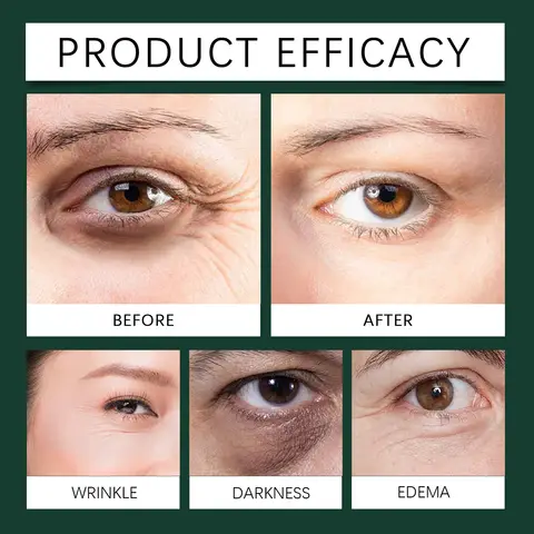 10 best sales आंखों में डालने की बूंदें - №1