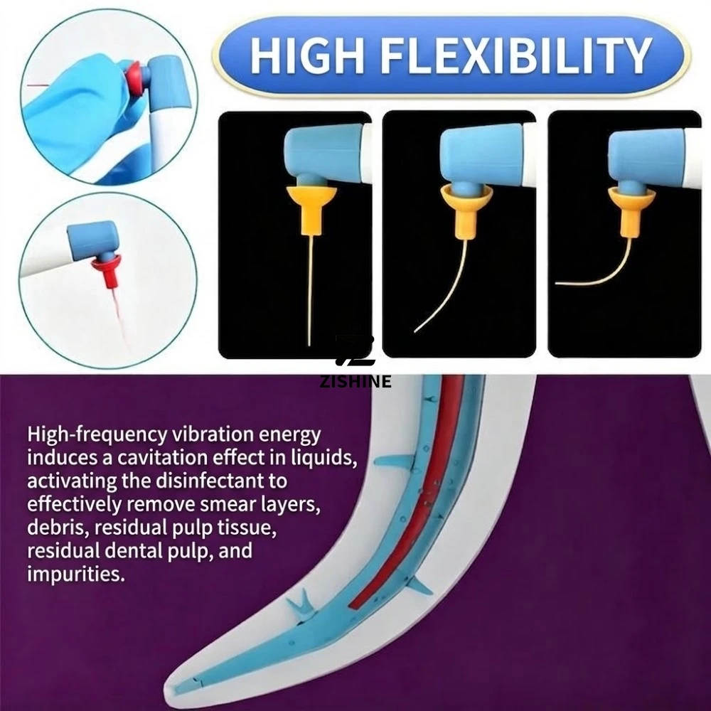30Pcs/3Boxes Dental Endo Sonic Activator Tips Flexible Composite Root Canal Flushing Scrubber Tips for Curved Canals