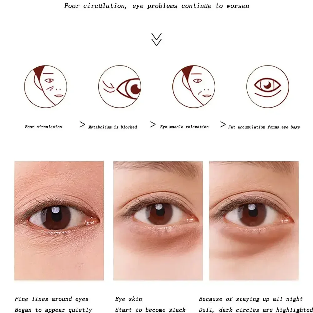 Shock Eye Cream  Anti Wrinkle Firming Moisturizing Desalination Dark Circles Morning and Night Electric Eye Cream