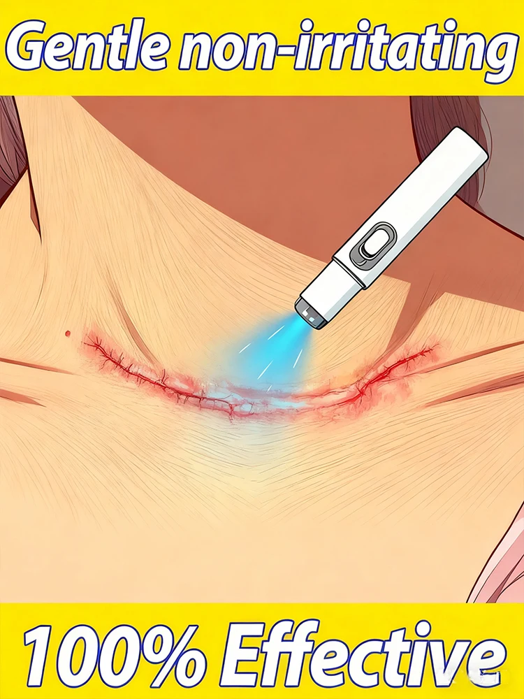 2025 new product The latest scar technology