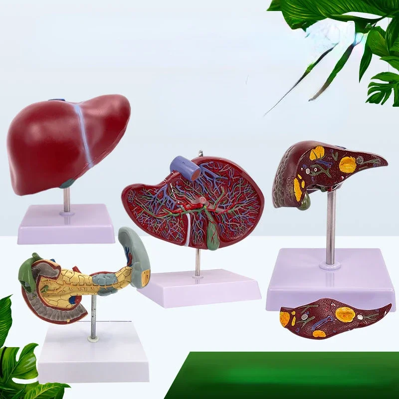 

Анатомическая модель печени человека с двойными поражениями, печенью, желчным пузырем, поджежными зонами, желчным пузырем, пищевыми органовми