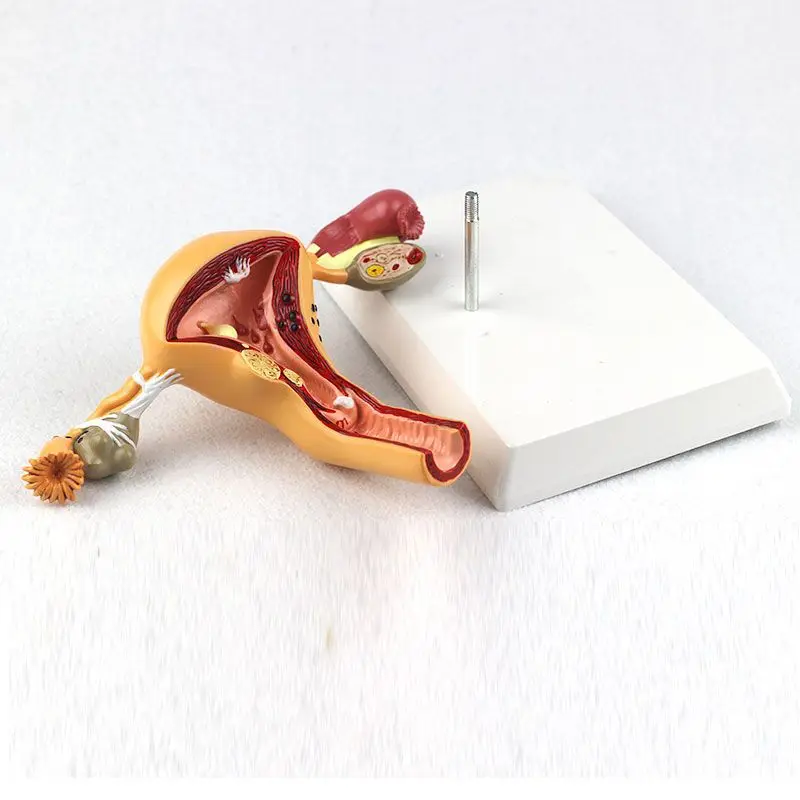 Human Model Female Reproductive Uterine Vaginal Ovarian Uterine Teaching Mold Pathology Popular Science Training Teaching Tool