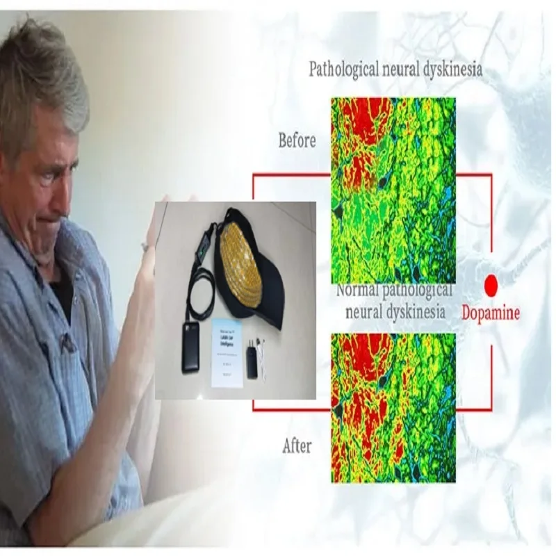 Parkinson Alzheimer Stroke Therapy Transcranial Magnetic Stimulator Photobiomodulation Helmet LED 810nm Cap for Brain Recovery