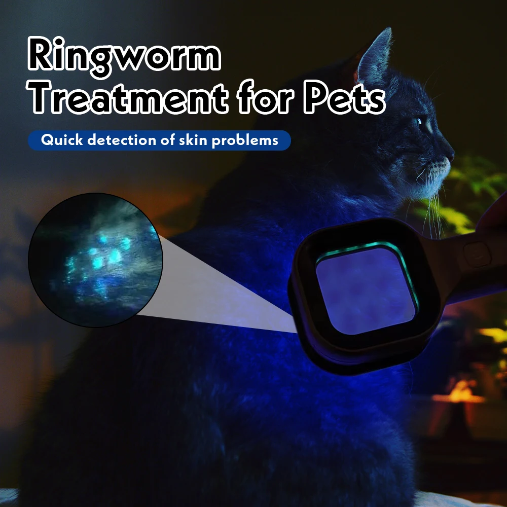 Medical Woods Lamp Skin Examination Device for Melasma, Fungus Detection, Vitiligo, and Pityriasis Versicolor