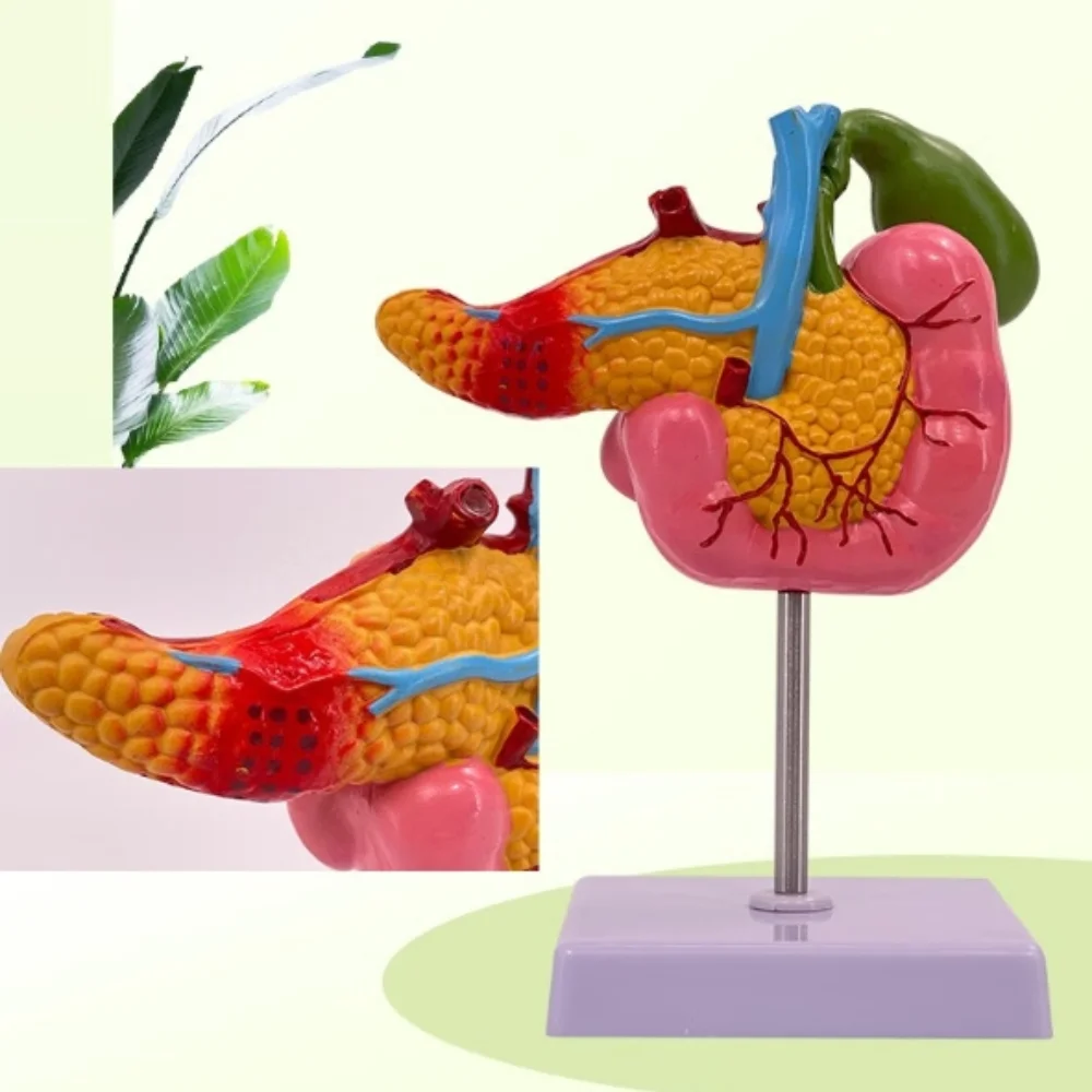 

High-quality pathological model of pancreaticoduodenal cholangiocarcinoma